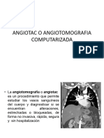 Angiotac o Angiotomografia Computarizada
