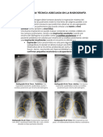 Técnica Radiológica Adecuada de Tórax