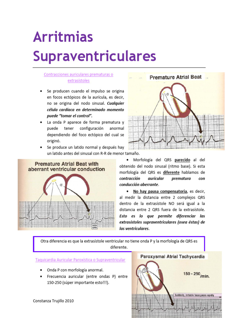 Extrasístoles y Taquicardias Auriculares | PDF | Electrocardiografia ...