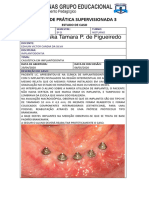 Editado - APS 3 - CASUISTICA EM IMPLANTODONTIA