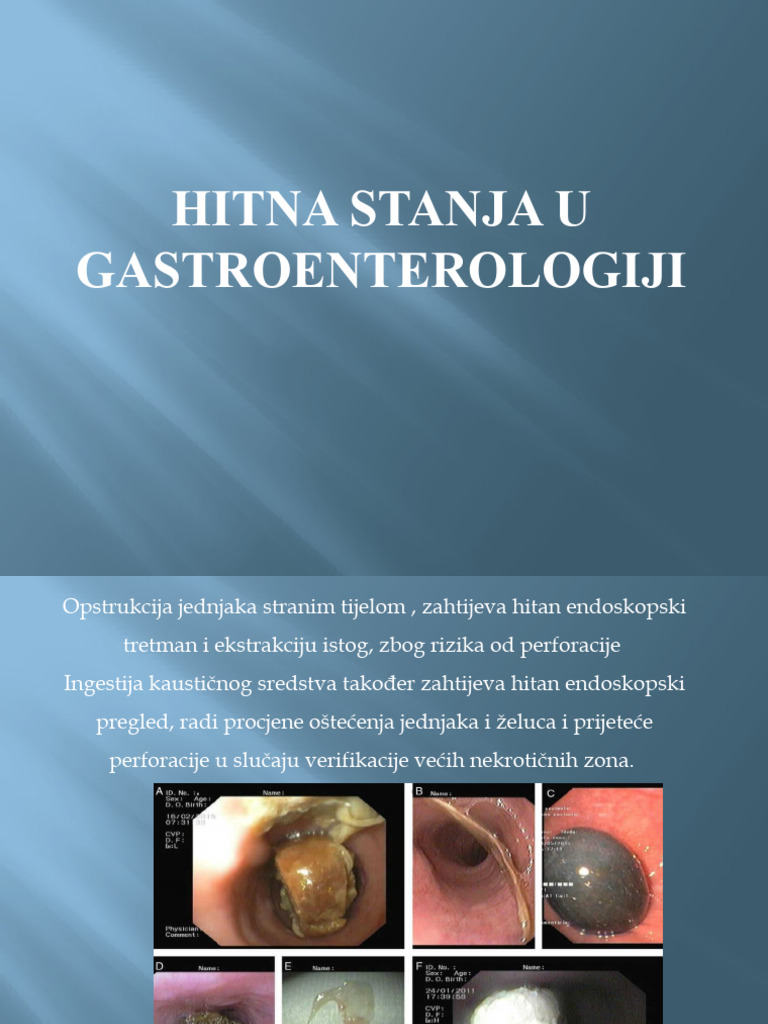 Hitna Stanja U Gastroenterologiji | PDF