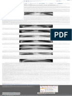 Residência Pediátrica - Leituras de Radiografias de Tórax em Crianças Suspeitas de Possuir Tuberculose Pulmonar 2
