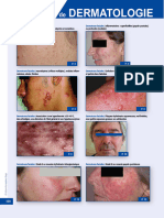 Atlas de Dermatologie - iKB Dermato 18