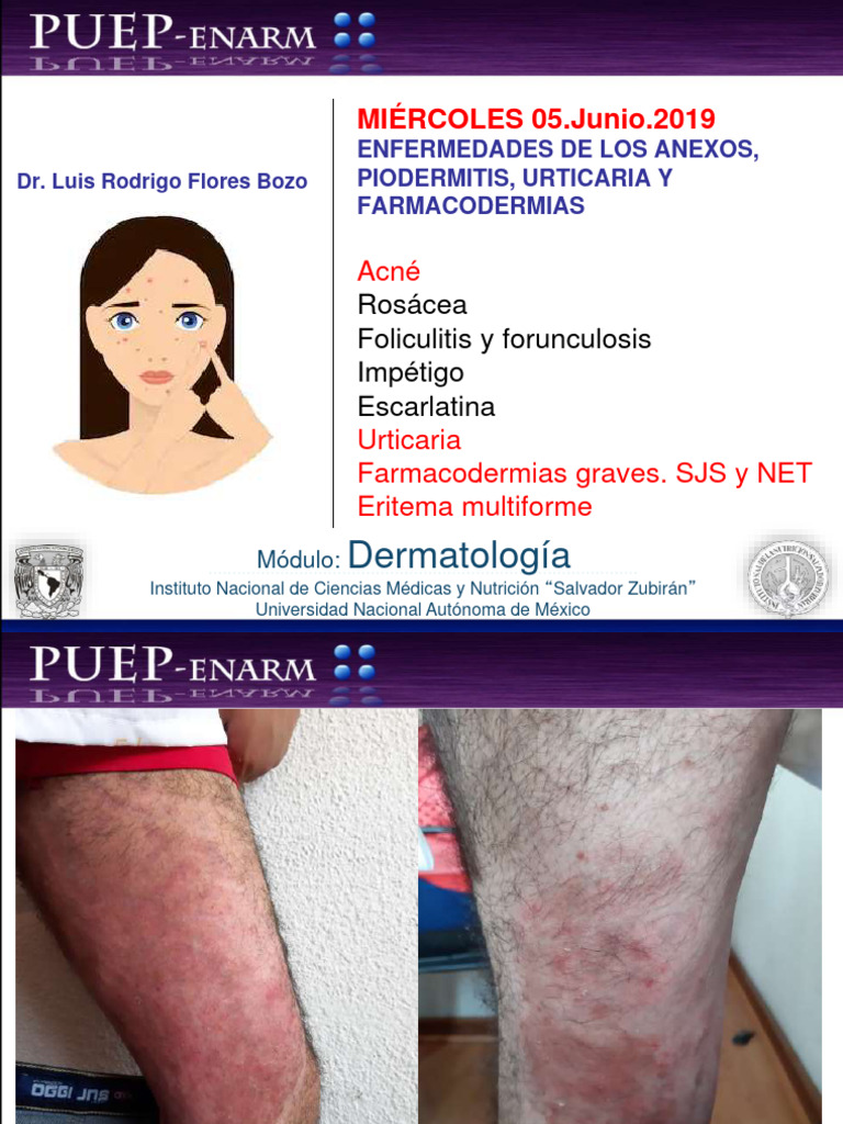 Clase - Derma2 .19 | PDF | Enfermedades y trastornos | Medicina CLINICA