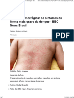 Dengue Hemorrágica Os Sintomas Da Forma Mais Grave Da Dengue - BBC News Brasil