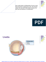 Uveitis