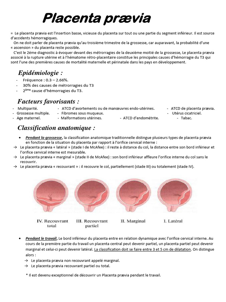 Classification du placenta prævia | PDF | Utérus | Placenta