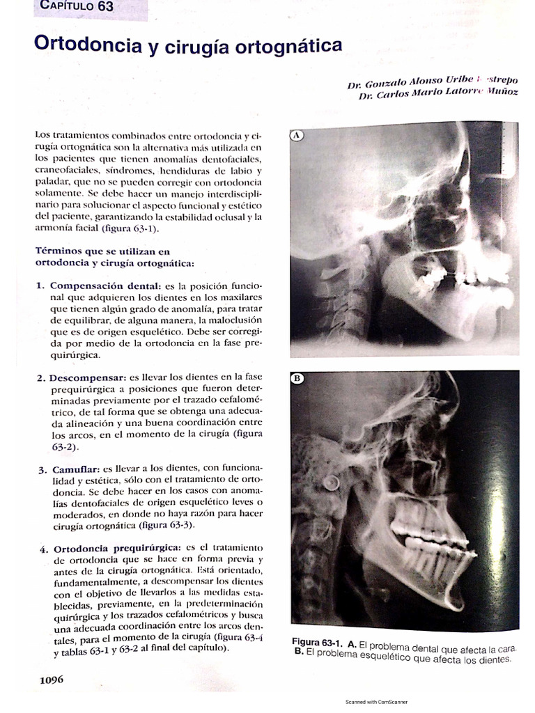 Ortodoncia y Cirugía Ortognática | PDF
