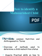 5 - Measuring A Malnourished Child