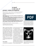 Acta Ophthalmologica Scandinavica - 2003 - Moschos - Juvenile Nasopharyngeal Angiofibroma A Rare Case of Primary Orbital