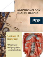 Hiatal Hernia