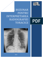 Ghid de Buzunar PT Interpretarea Radiografiei Toracice 2013