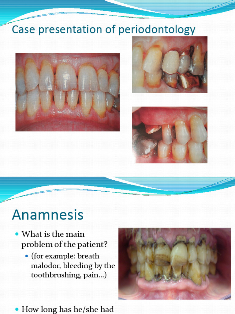 Case Presentation | PDF | Periodontology | Dentistry