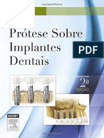 Resumo Protese Sobre Implantes Dentais Carl e Misch