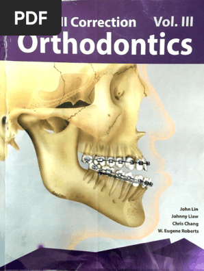 健康・医学 269 Class III Correction Orthodontics Class III Correction Vol III Orthodontics John Lin, Chris Chang | PDF