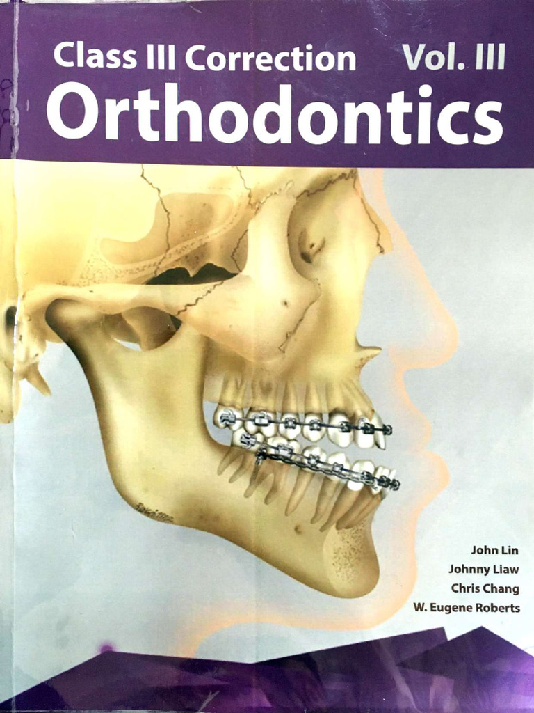 健康・医学 269 Class III Correction Orthodontics Class III Correction Vol III Orthodontics John Lin, Chris