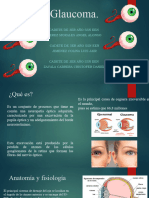 Glaucoma Nueva