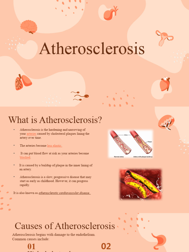 Understanding Atherosclerosis Risks | PDF | Atherosclerosis | Atheroma