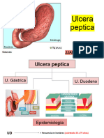 Ulcera Peptica (Expo en Gastrologia)