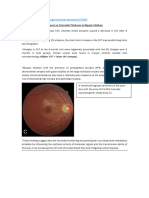 Discussion On Choroidal Thickness