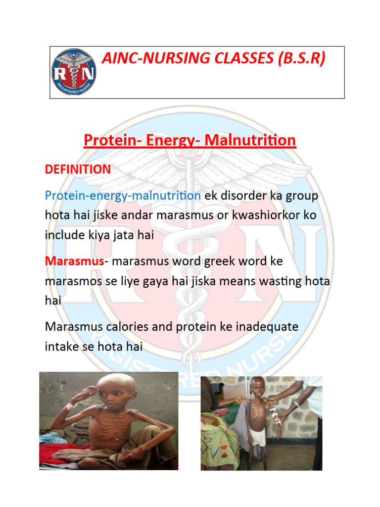 AincNursing Classes (B.S.R) ProteinEnergy Malnutrition Download