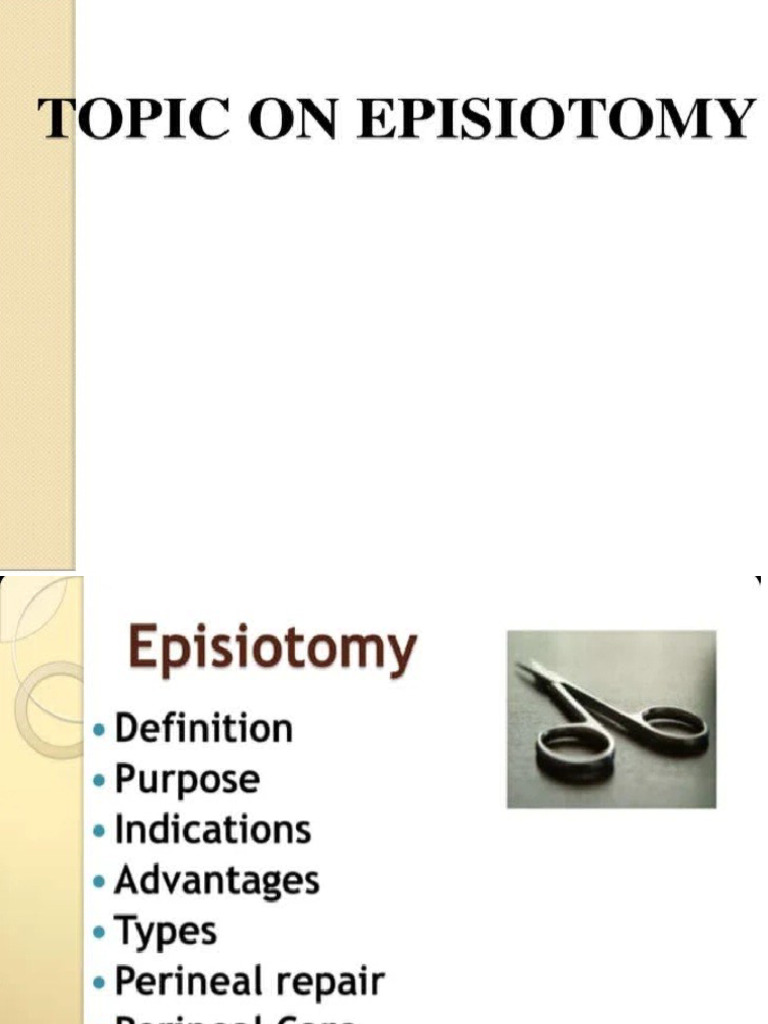 Episiotomy Procedure 2023 PDF