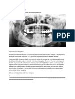 Prostodoncia Removible Tarea 1