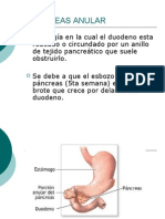 Pancreas Anular