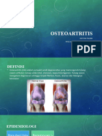 Osteoartritis