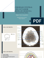 Cortes Tomográficos