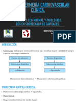 Ecg Sobrecarga de Cavidades