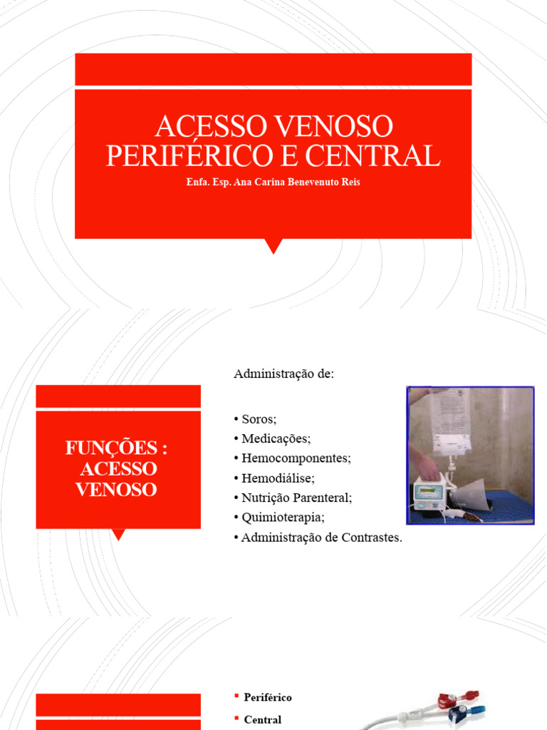 Acesso Venoso: Tipos e Cuidados | PDF | Veia | Infecção
