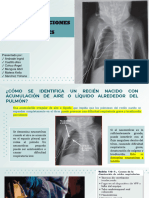 Consideraciones Especiales de La Reanimacion Neonatal