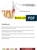 Bolsa Periodontal