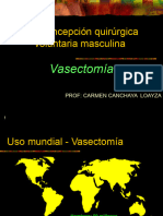 Vasectomia Clase