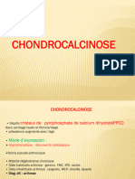 Chondrocalcinose