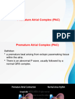 Premature - Atrial - Complex Final