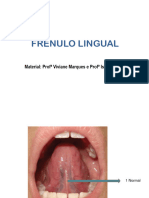 Frenulo Lingual