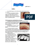 Dental Calculus