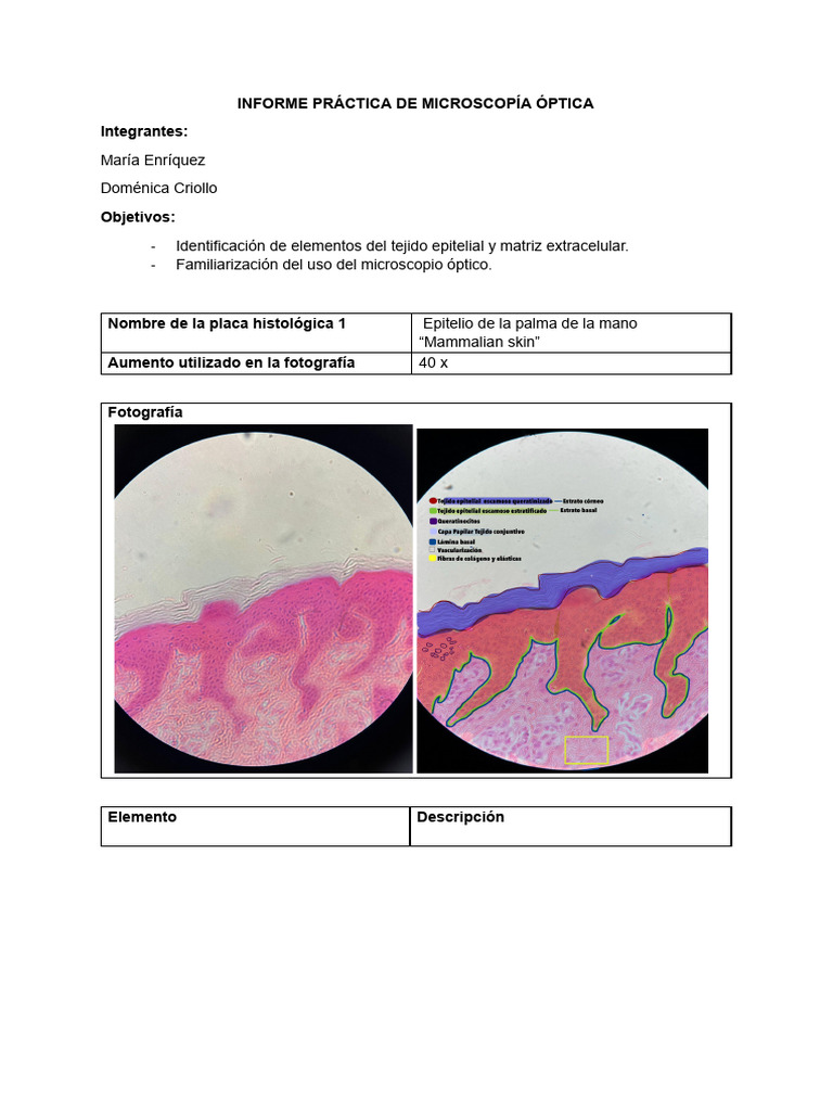 Práctica de Microscopía Óptica en Tejidos | PDF | Hueso | Epitelio