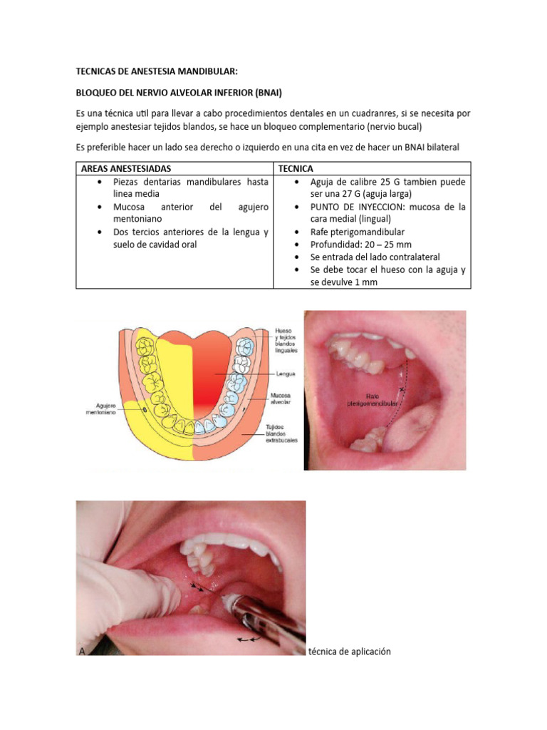 Técnicas de Anestesia Mandibular | PDF | Diente | Boca