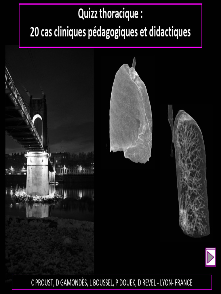 20-cas-thorax-c-proust-2011fileminimizer-pdf