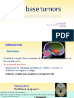 Skull Base Tumors NBN