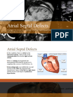 Atrial Septal Defects