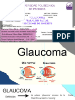 Glaucoma, Paralisis Facial, Sindrome de Moebius - 127328