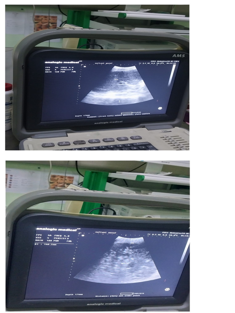 Usg Abdomen Pdf