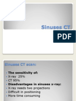 Sinuses CT