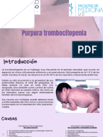 Purpura Trombocitopenia