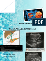 Neoplasias Pancreatica
