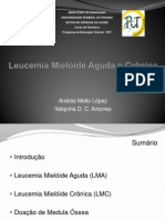 Leucemia Mieloide Aguda e Cronica